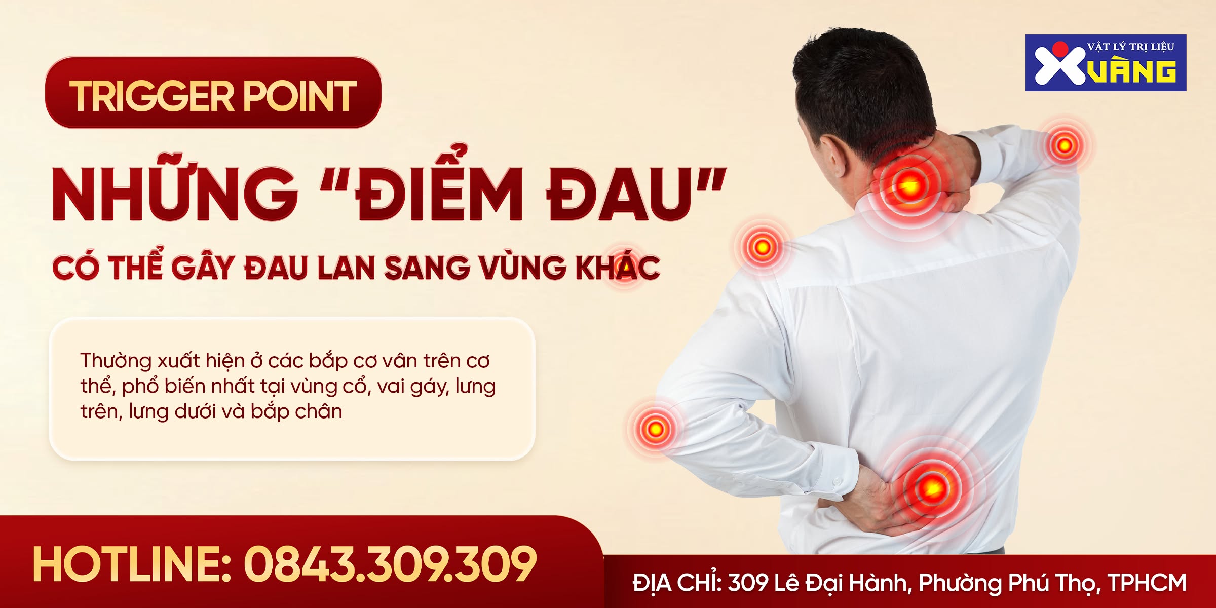 Minh họa các điểm đau trigger point trên cơ thể